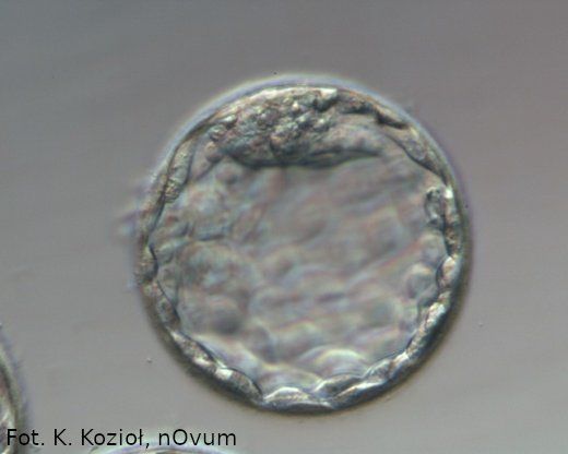 blastocysta 5 dni