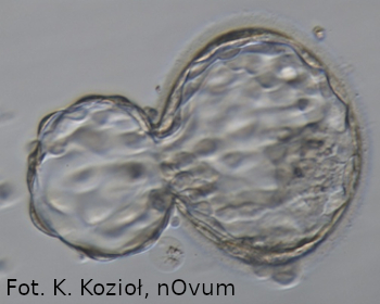 blastocysta wykluwająca się