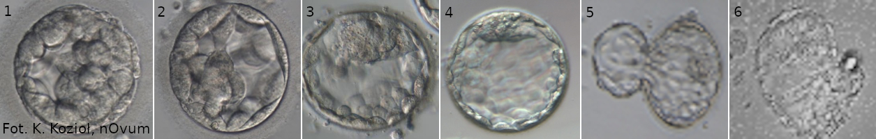 stopień ekspansji blastocysty