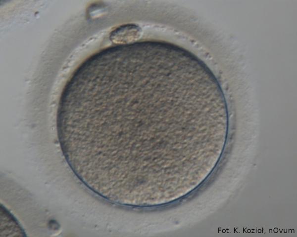 dojrzała komórka jajowa