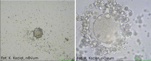 dojrzałe komórki jajowe