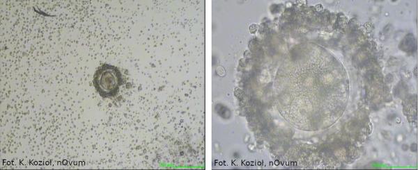 niedojrzałe komórki jajowe