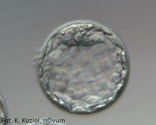 blastocysta 5 dni